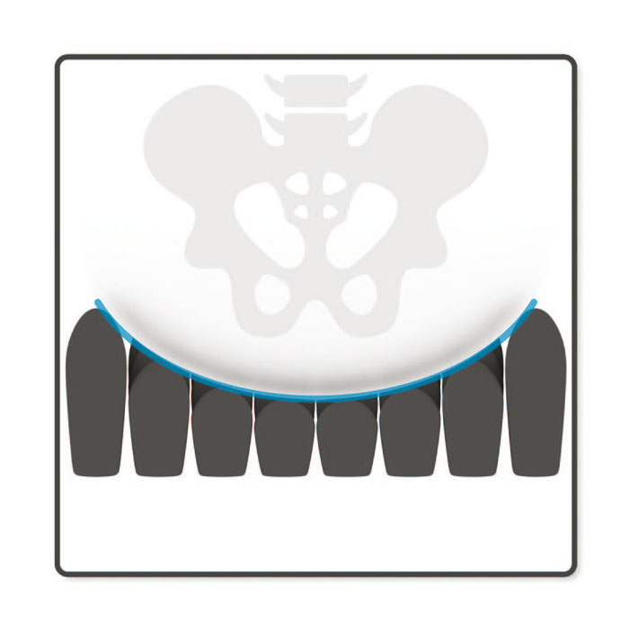 Roho Mosaic kussen ROHO_bescherming